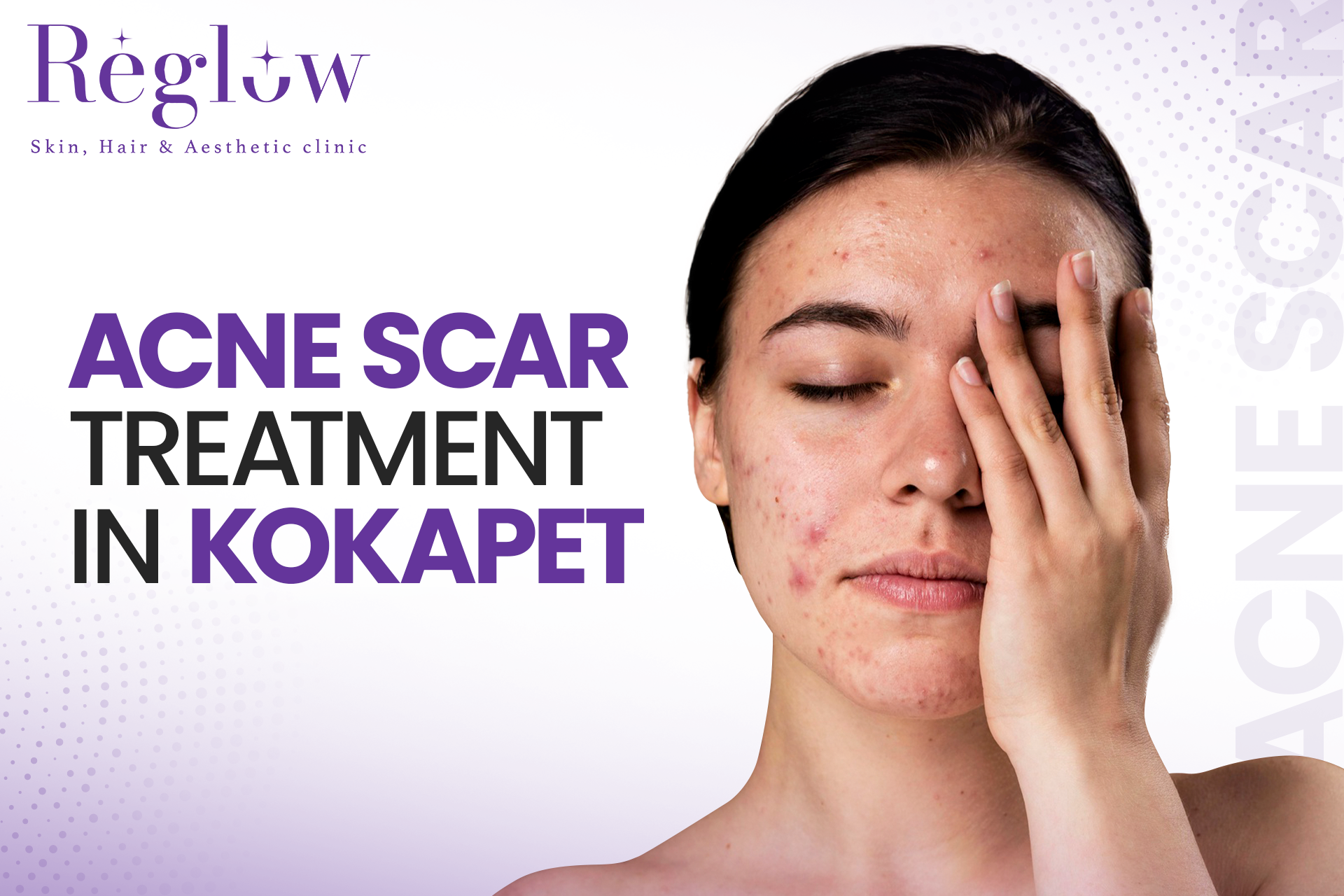 Acne Scar Treatment in Kokapet: Cost and Process