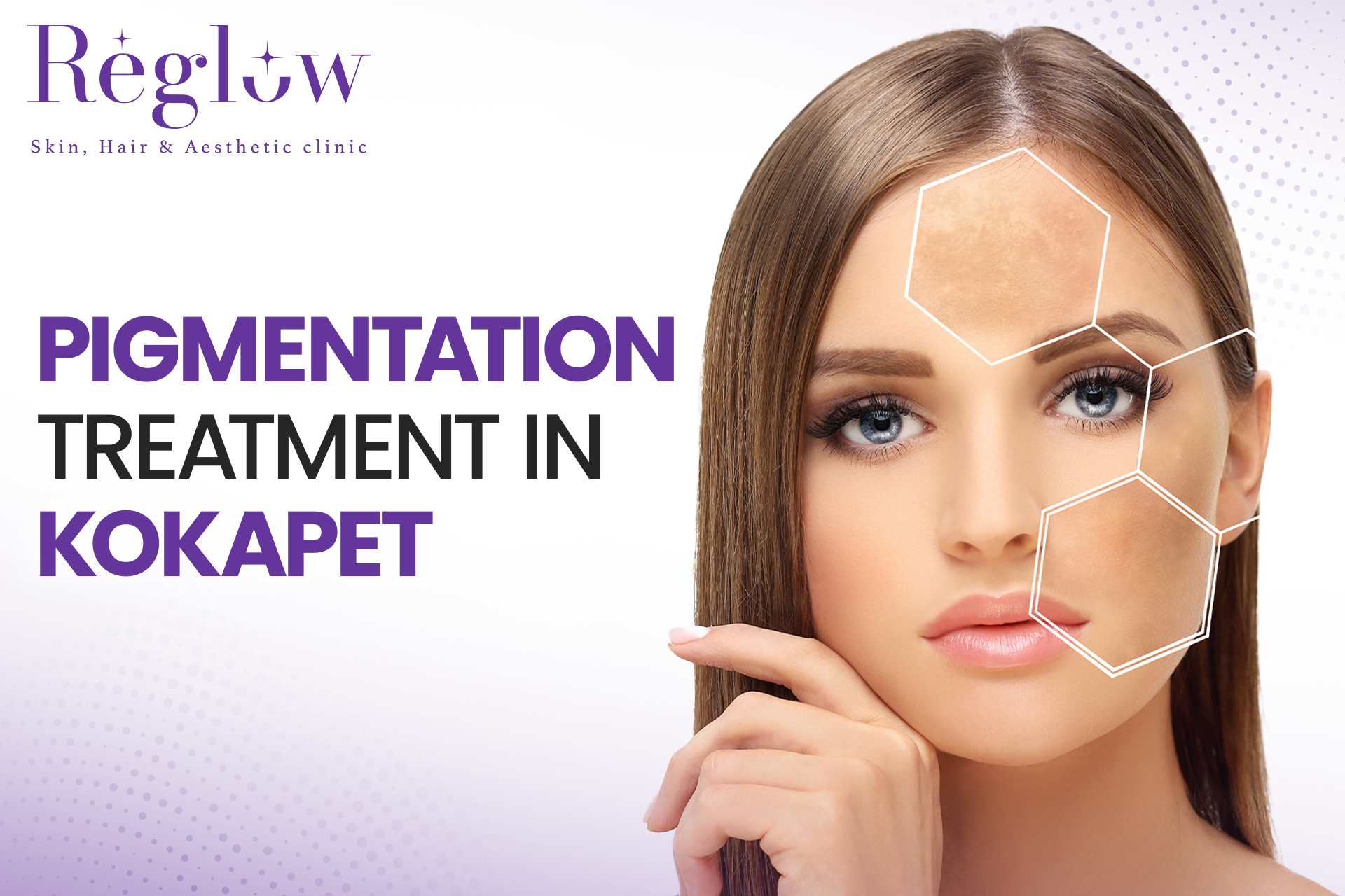 Pigmentation Treatment in Kokapet – Reglow Skin, Hair & Aesthetic Clinic