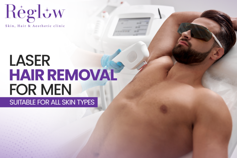 Laser Hair Removal for Men in Kokapet – Reglow Skin, Hair & Aesthetic Clinic