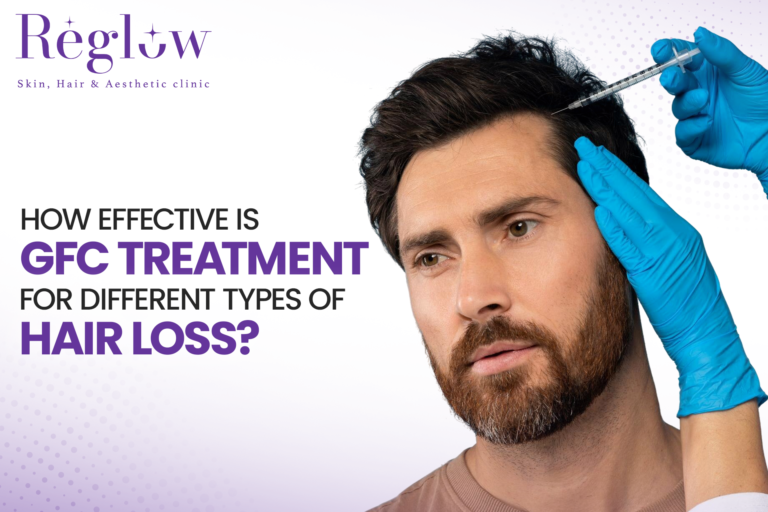 How Effective is GFC Treatment for Different Types of Hair Loss?