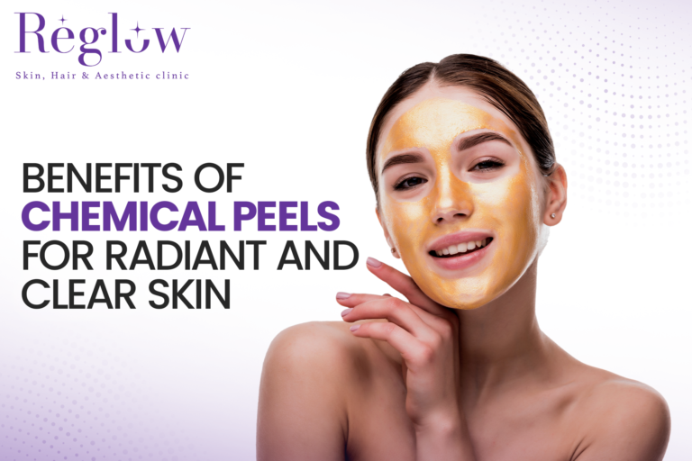 Benefits of Chemical Peels for Radiant, Clear Skin – Reglow Skin, Hair & Aesthetic Clinic