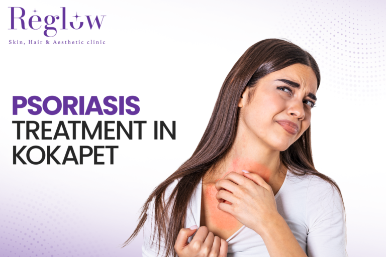 Psoriasis Treatment in Kokapet – Reglow