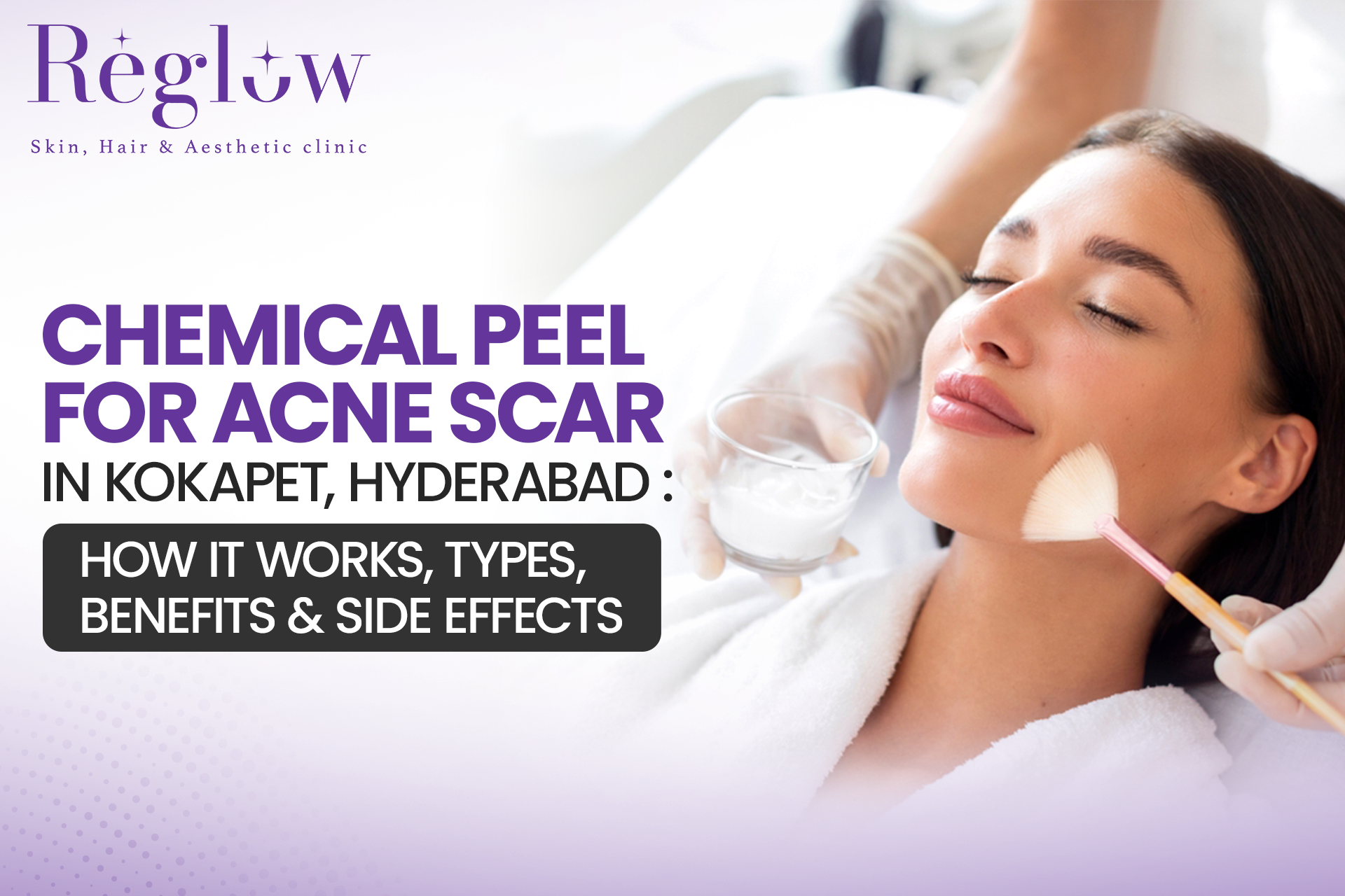Chemical Peel for Acne Scar in Kokapet, Hyderabad: How It Works, Types, Benefits & Side Effects