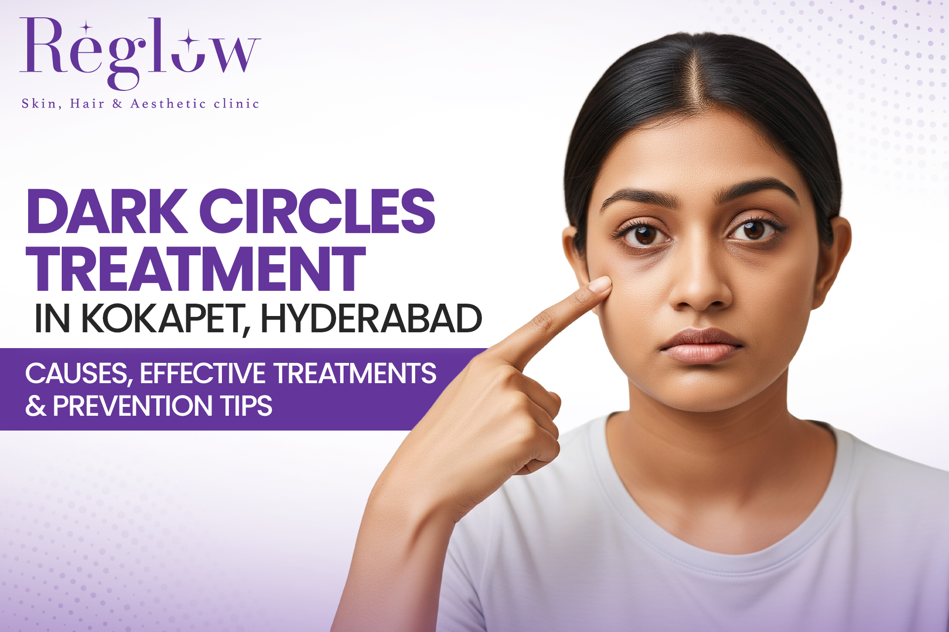 Dark Circles Treatment in Kokapet, Hyderabad: Causes, Effective Treatments, and Prevention Tips