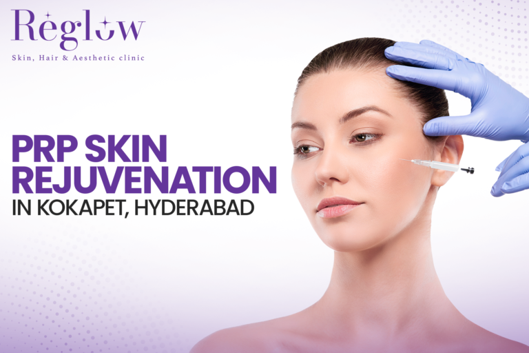 PRP Skin Rejuvenation in Kokapet, Hyderabad – Reglow Skin, Hair & Aesthetic Clinic