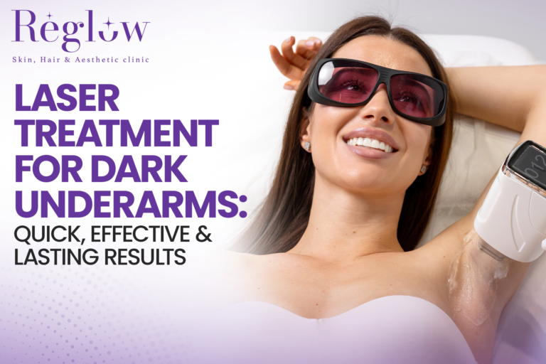 Laser Treatment for Dark Underarms: Quick, Effective, and Lasting Results