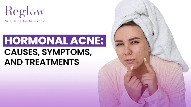 Hormonal Acne: Causes, Symptoms, and Treatments – Reglow Skin, Hair & Aesthetic Clinic